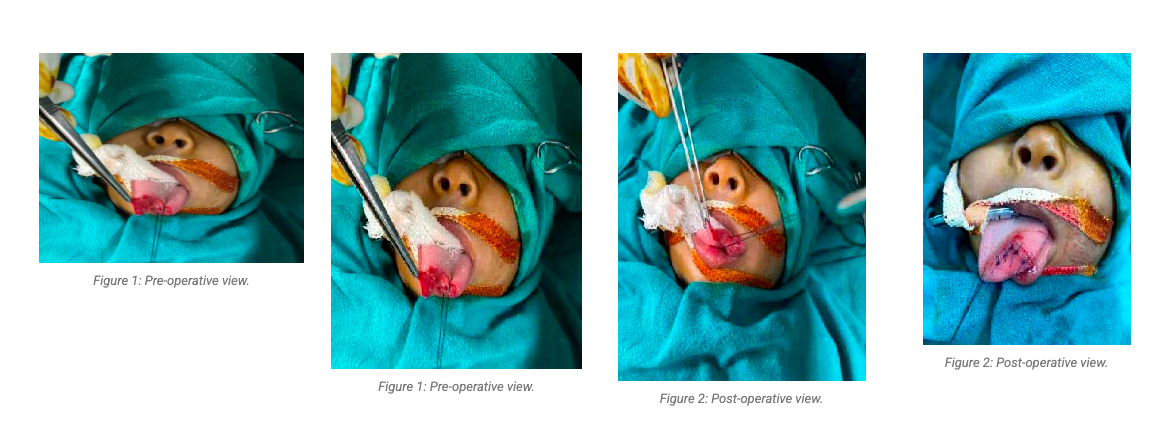 case-study-image